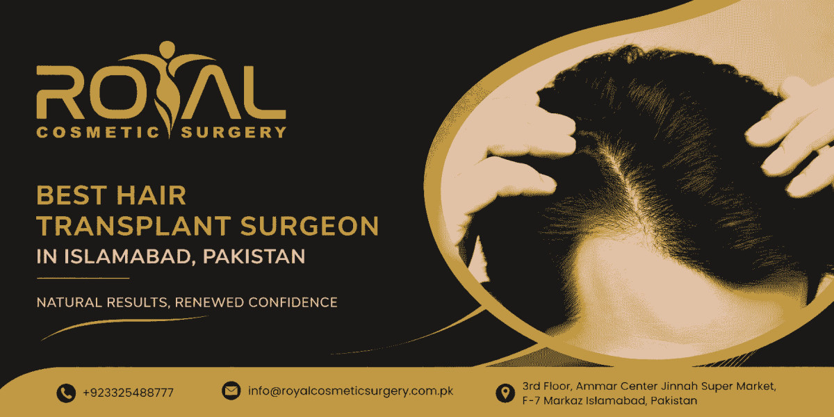 Best Hair Transplant Surgeon: Questions to Ask Before Surgery