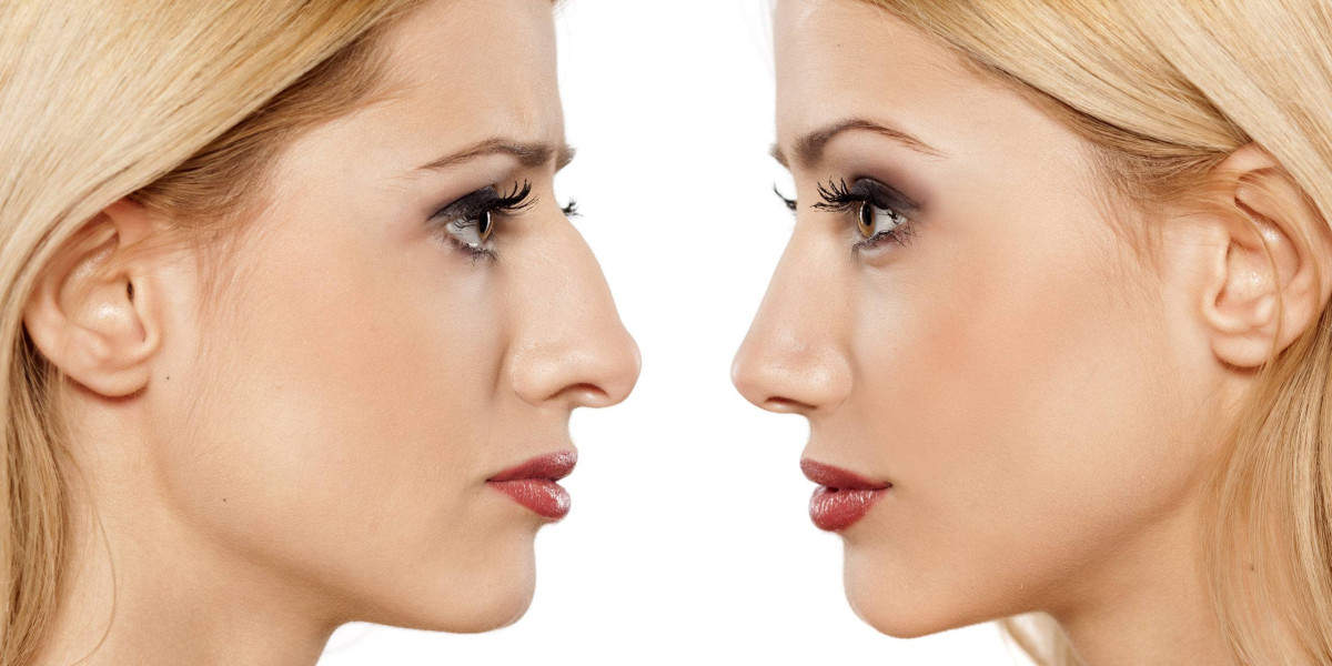 The Consultation Masterclass: Preparing for Your Surgical Dialogue
