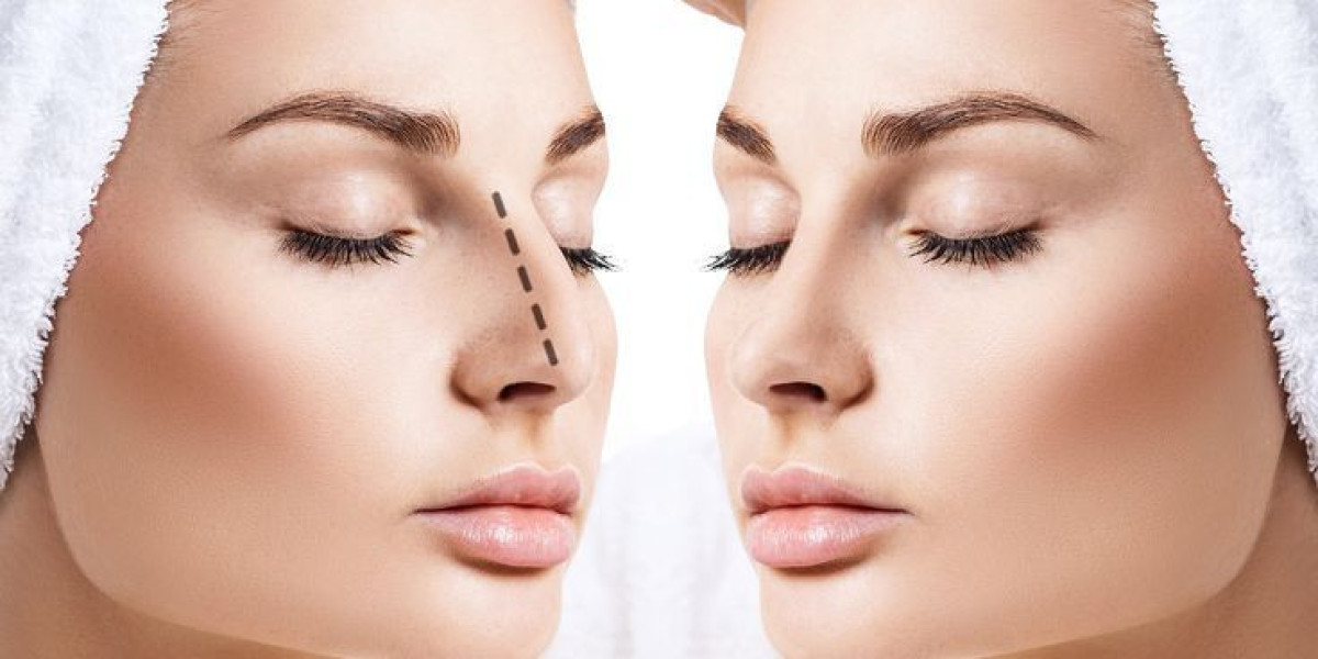 Rhinoplasty in Dubai: Transforming Confidence and Shape
