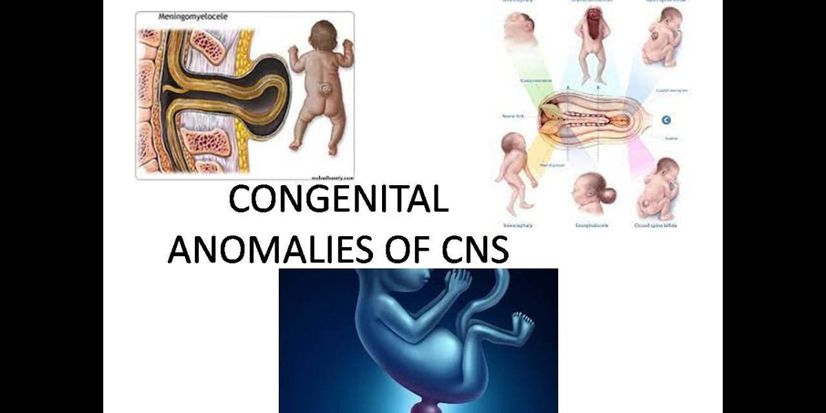 Addressing Neural Tube Defects: Congenital Anomalies in Riyadh