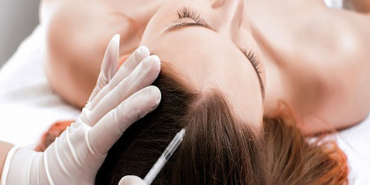 Hair Fillers treatment in Dubai: Advanced Scalp Nutrition