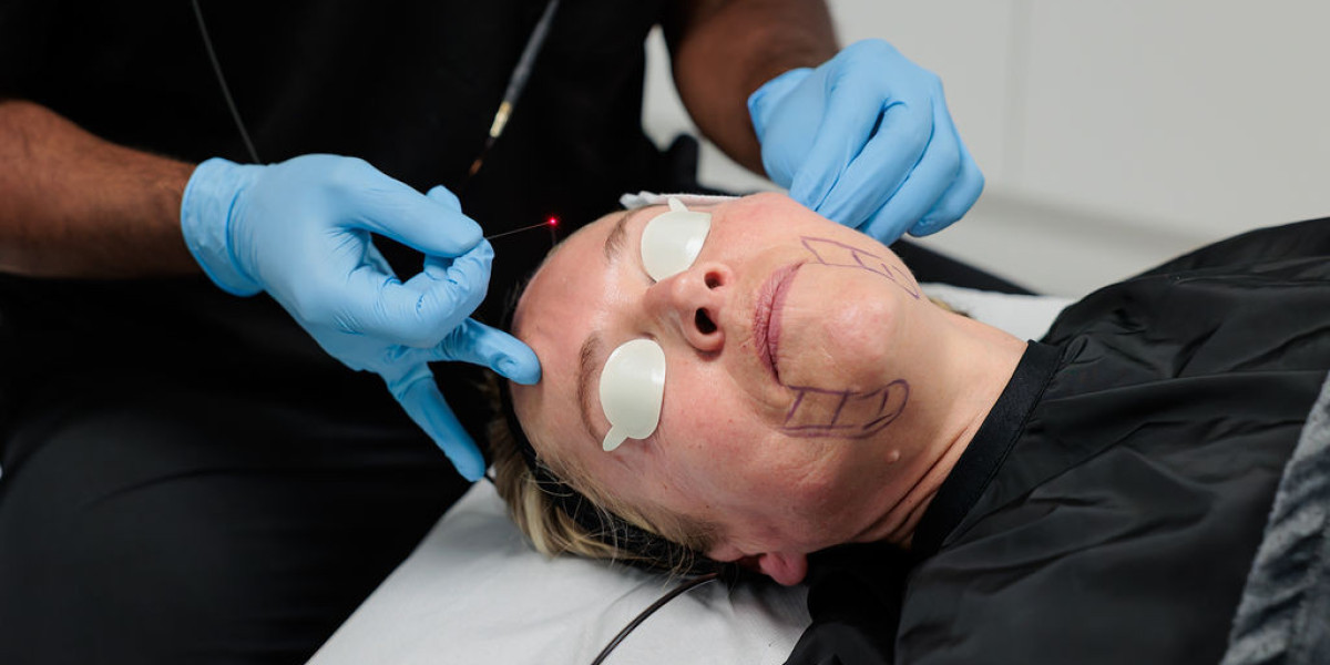 Endolift in Dubai with Gentle Skin Remodeling