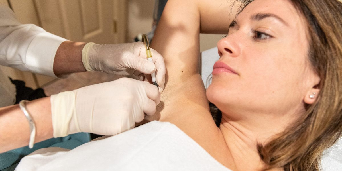 Electrolysis Laser Hair Removal Islamabad: Can It Treat Stubborn Hair Effectively?