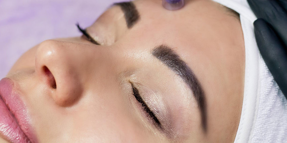 Microneedling with PRP in Dubai Natural Results
