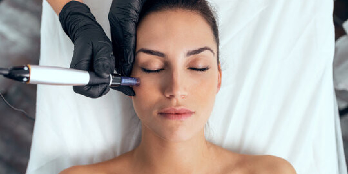 Microneedling with PRP in Dubai for Facial Refresh