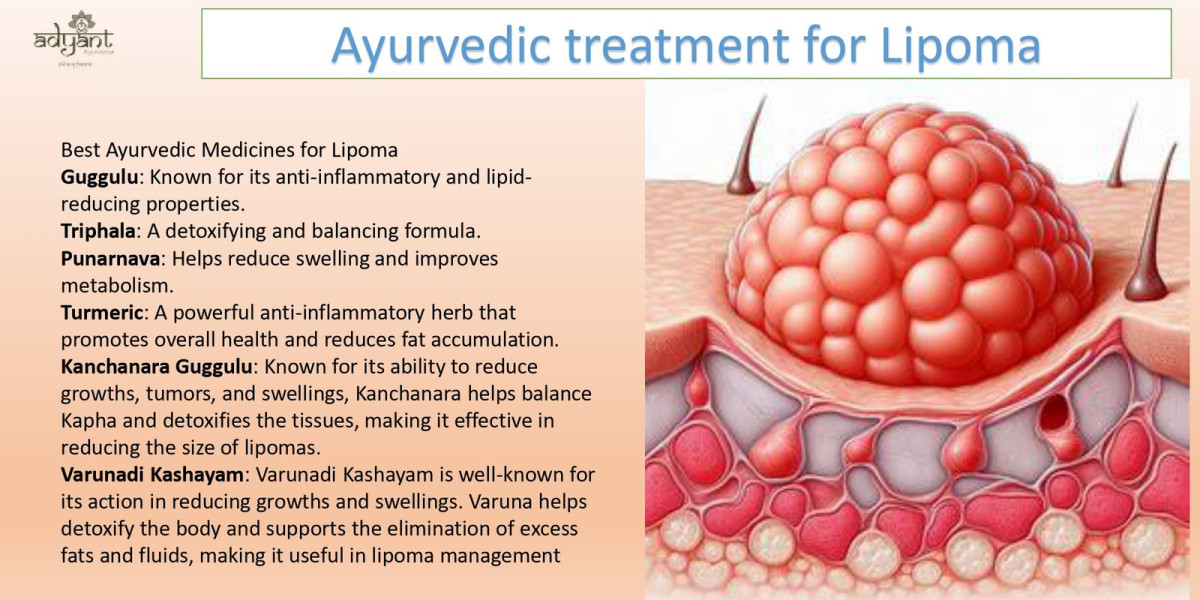 Lipoma Treatment in Jeddah: Understanding Benign Fatty Lumps and Their Management