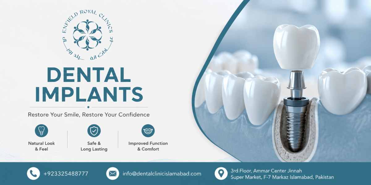 Discover the Best Dental Implants in Islamabad Today
