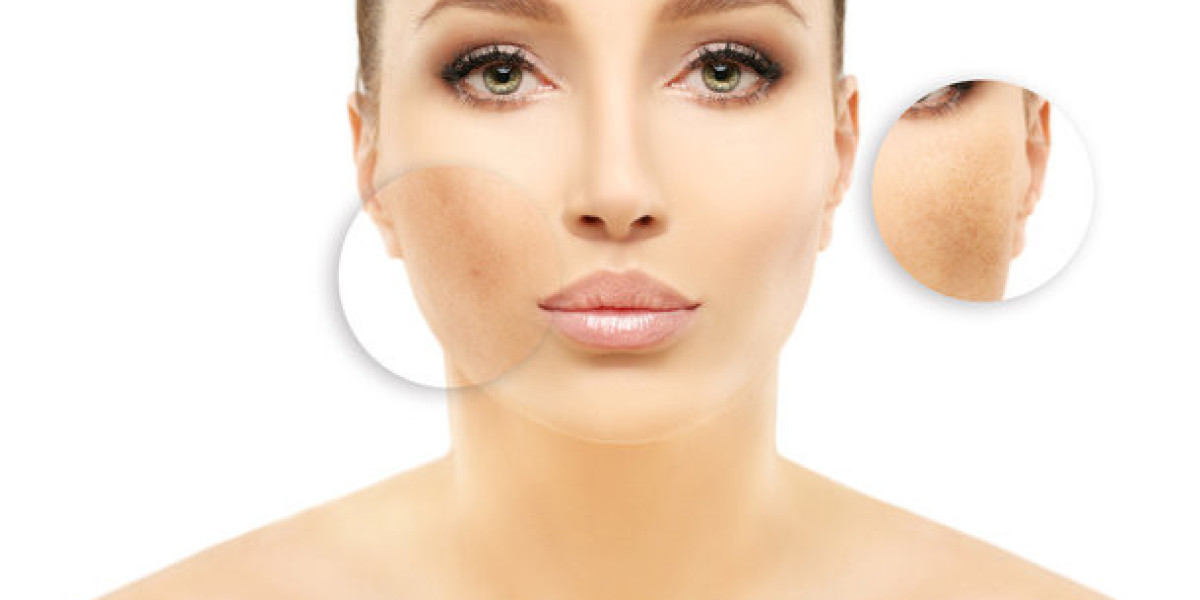Best Skincare Tips for Pigmentation in Dubai