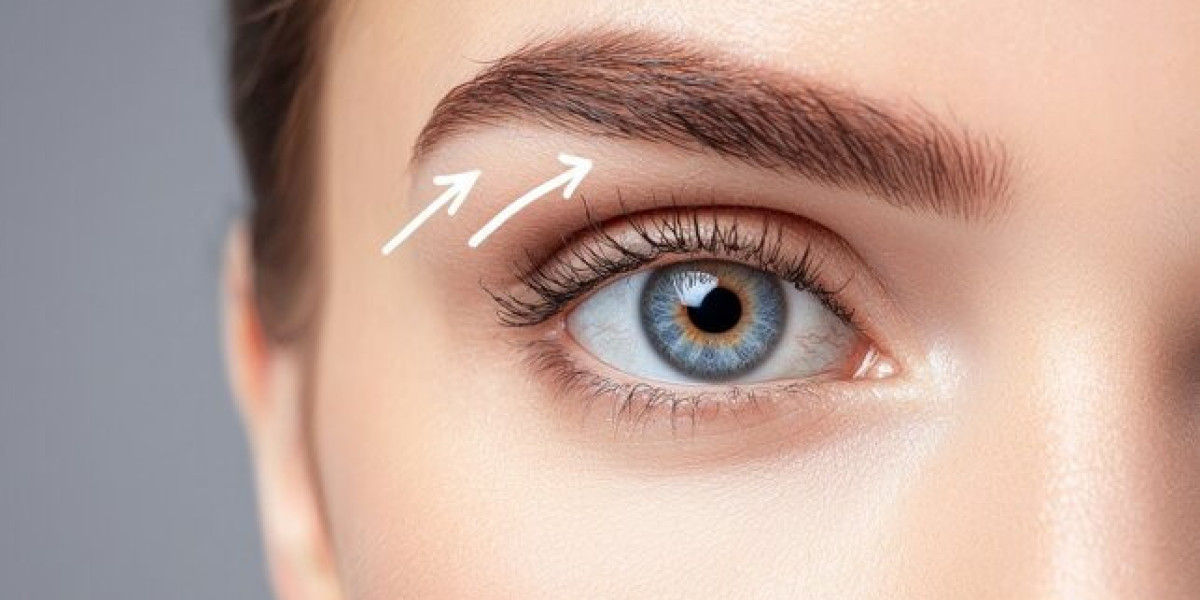 Brow Lift Surgery in Dubai for Balanced Features