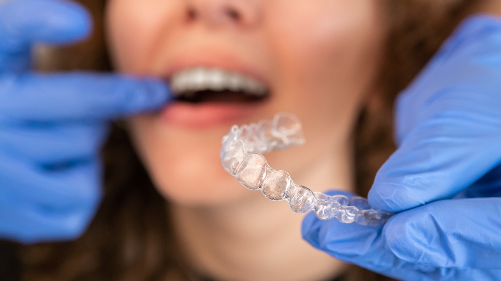 What to Expect During Your Invisalign Journey - Swan Orthodontics