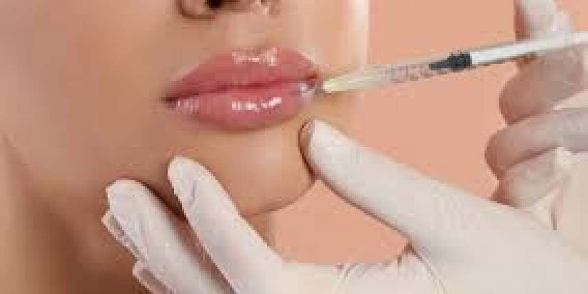 Natürlich schöne Lippen durch moderne ästhetische Methoden