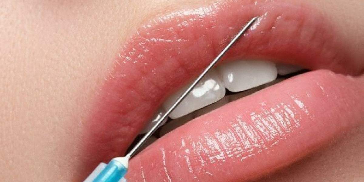 Article Picture