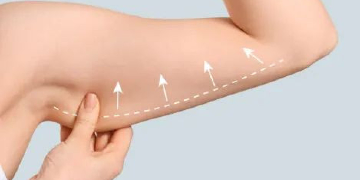 Arm Lift Surgery in Dubai: Surgical Mastery & Aesthetics