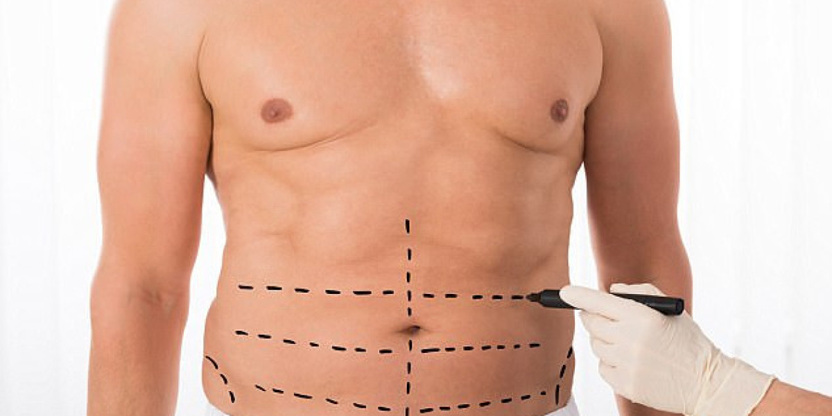 Article Picture