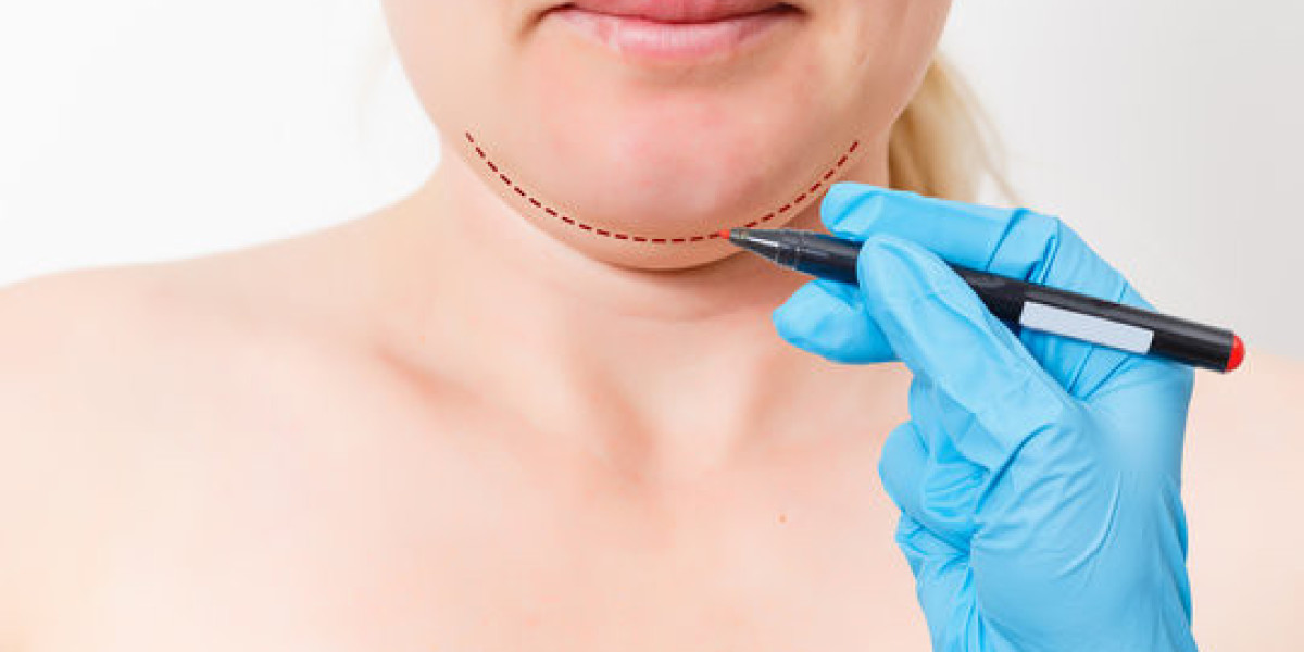 Chin Reduction in Jeddah: A Guide to Reducing Excessive Chin Projection
