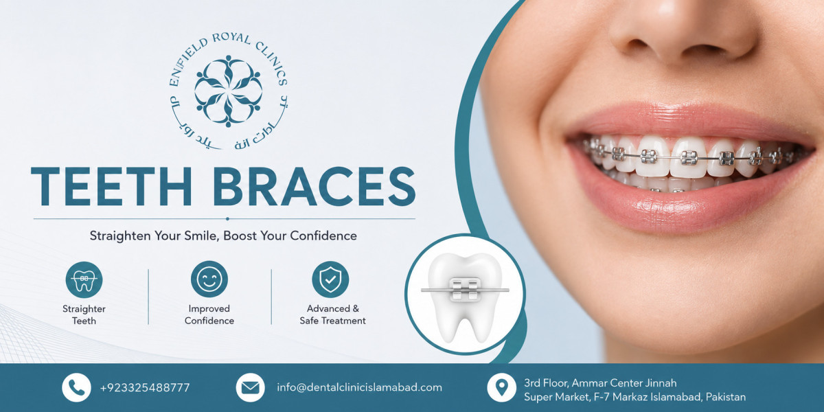 Why Choose Teeth Braces in Islamabad for Smile Correction?