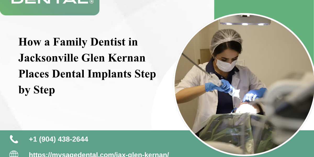 How a Family Dentist in Jacksonville Glen Kernan Places Dental Implants Step by Step