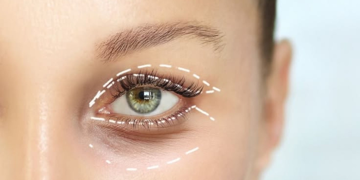 Blepharoplasty in Dubai: Renew Your Gaze