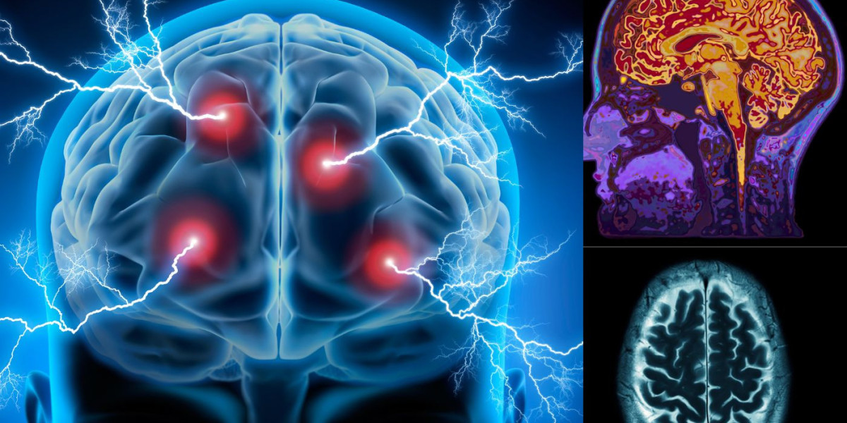 Best MRI Scan Centre in Nagpur with Trusted Diagnostic Care