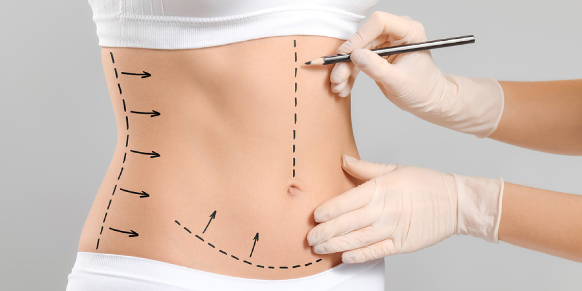 Common Myths About Liposuction in Riyadh
