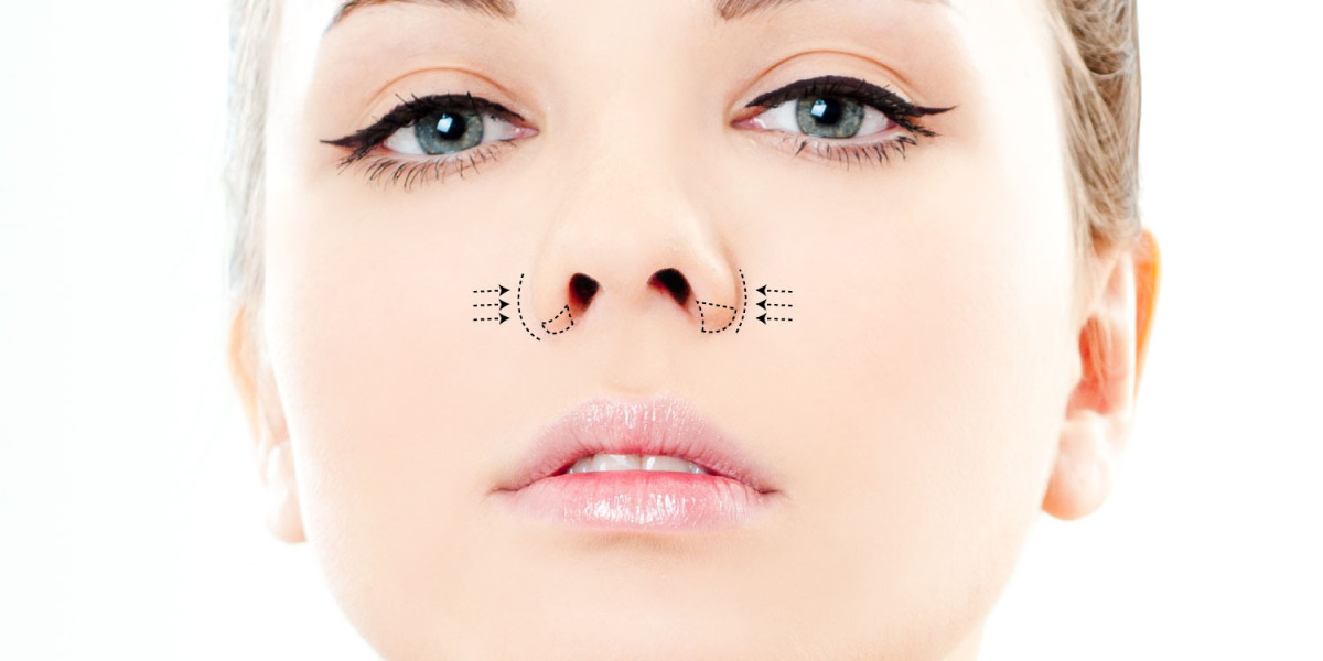 Alarplasty in Jeddah: Achieving a Refined Nose Shape Through Nostril Enhancement