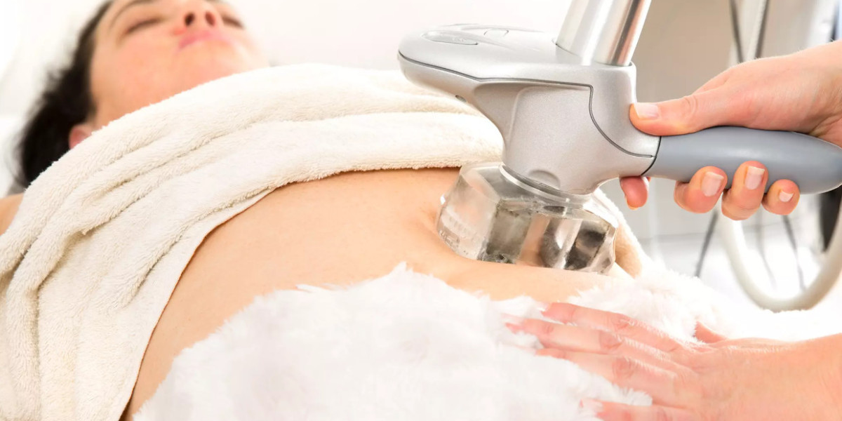 Radiofrequency Treatments for Body Contouring