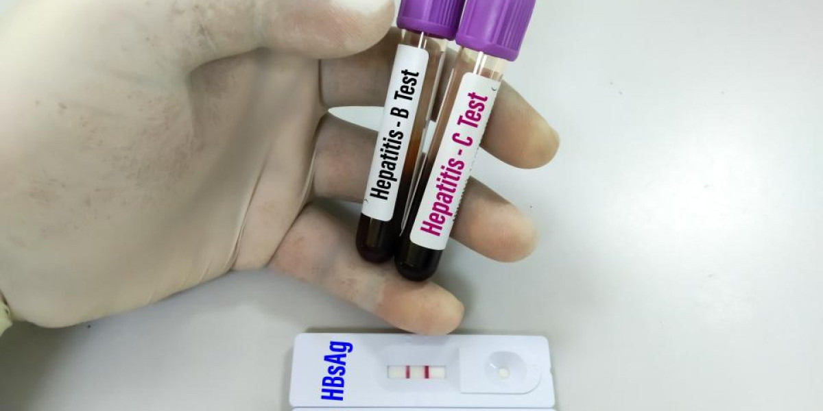 How Blood Tests Help Identify Hepatitis B