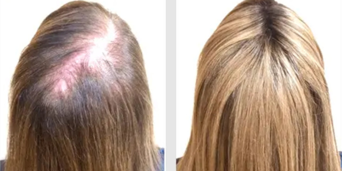 BioGrow Advanced Hair Regrowth US CA: Assessing Core