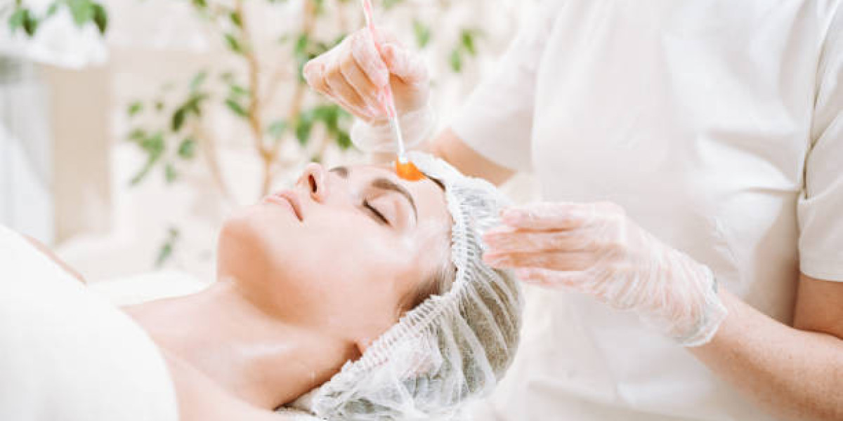 Chemical Peels in Dubai and Skin Renewal