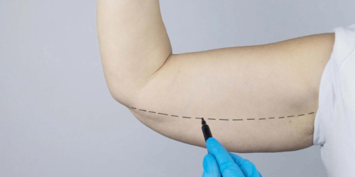 Nutrition Tips During Arm Lift Recovery