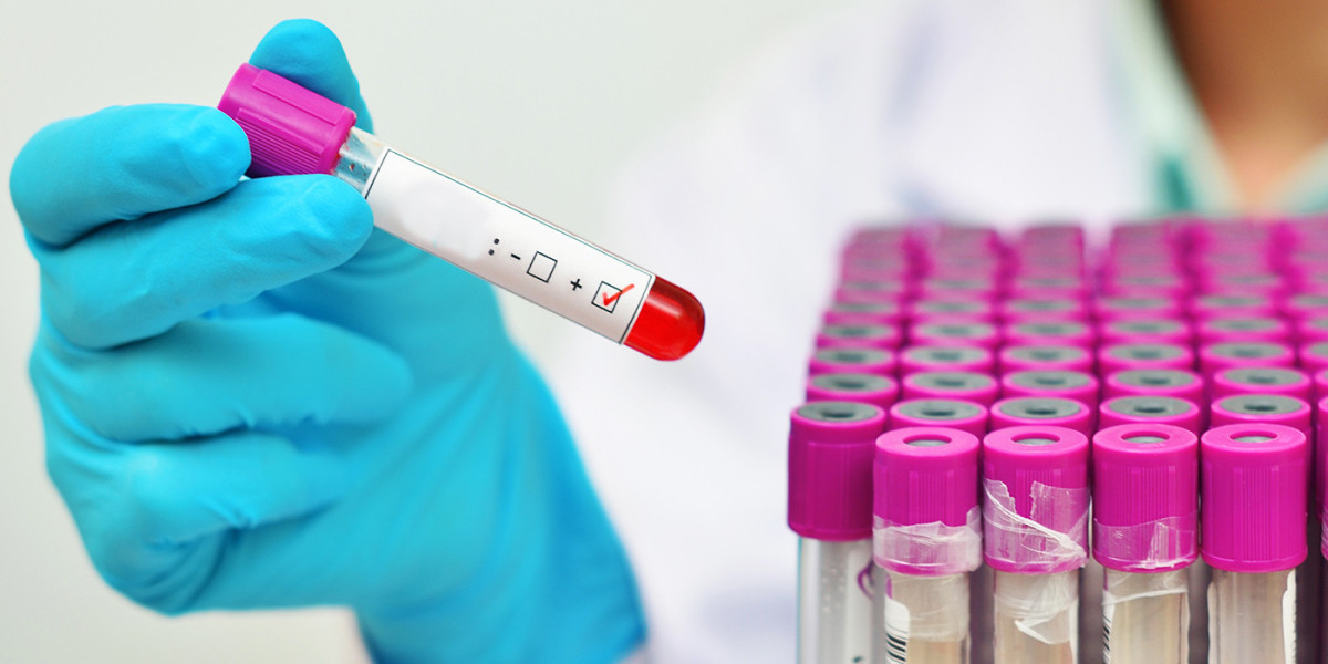 HIV Testing Before Starting Medical Treatment